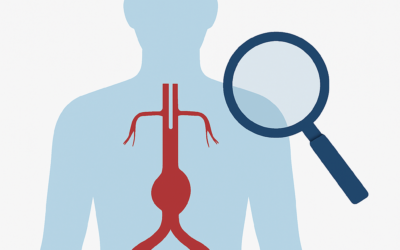 Screening aneurysmatu abdominální aorty – nový program od 1. 4. 2025